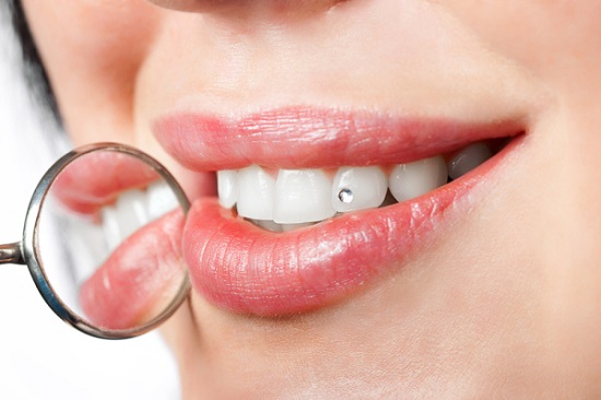 Dental jewelry looks great