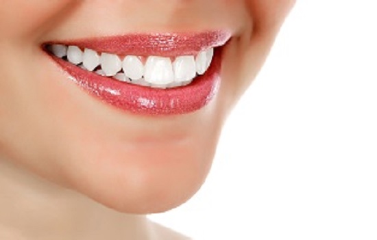 Smile happily with new white veneers