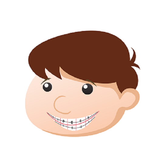 Ein Kind mit einer Zahnspange