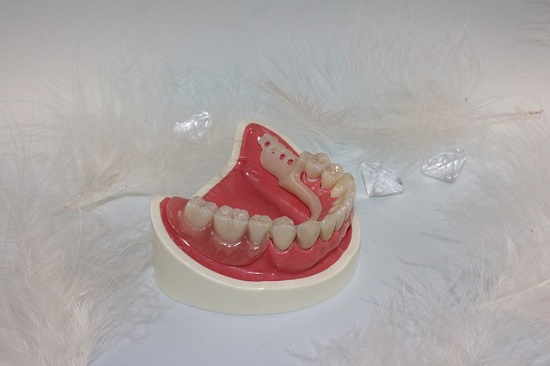 Denture for the lower jaw