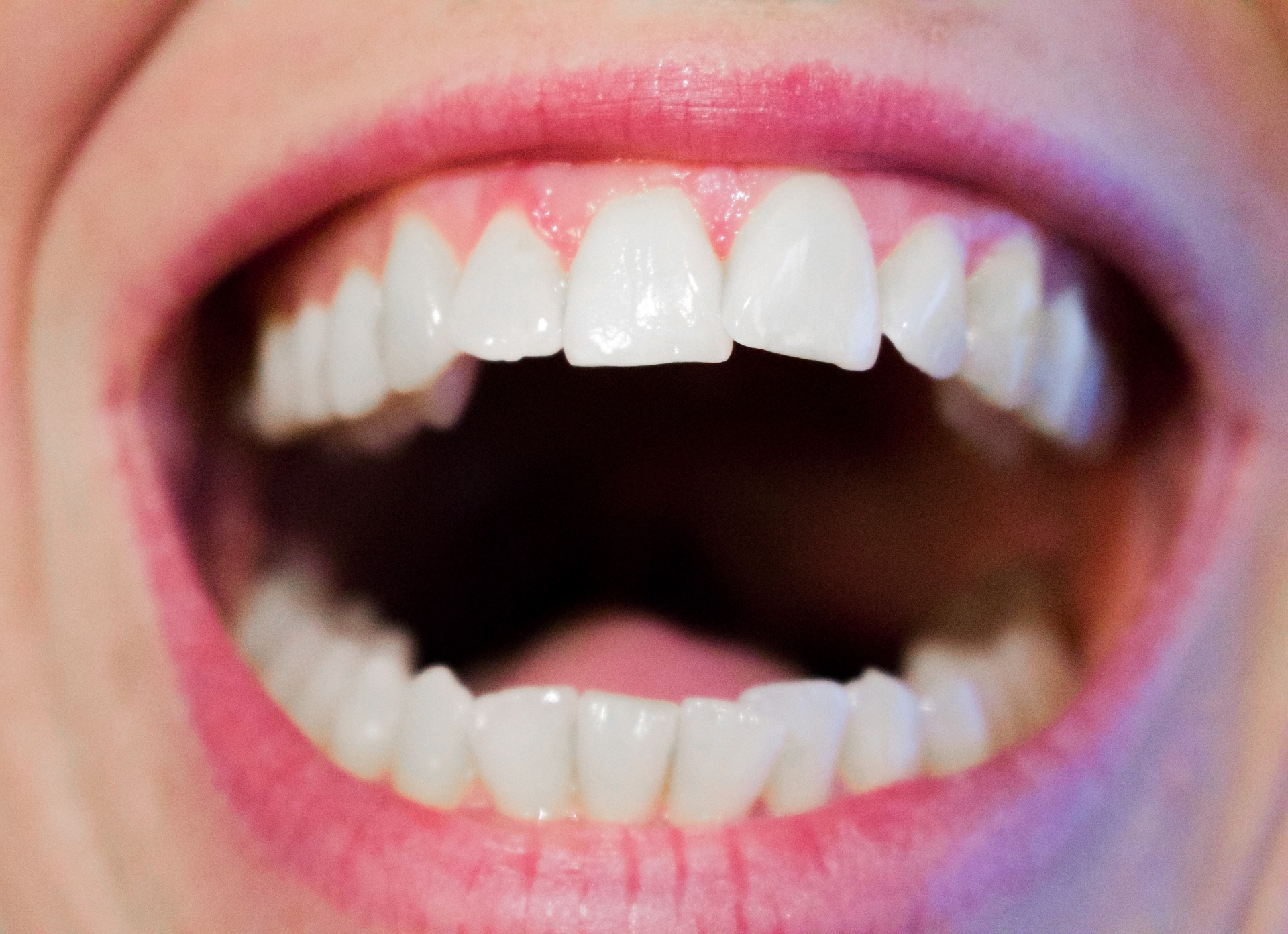 Junge Frau lacht nach dem Kauen eines Zahnpflegekaugummis