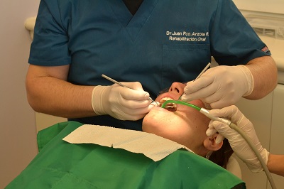 Gingivitis treatment at the dentist
