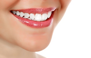 Veneers help you smile confidently again