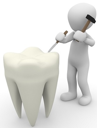 Sanftere Zahnbehandlungen mit Laser