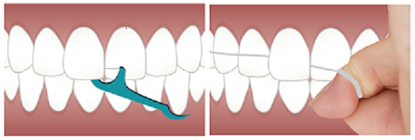 Dental floss placker or waterpick