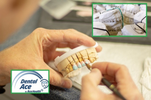 Dental lab value add picture