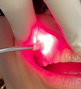 Lasertherapie